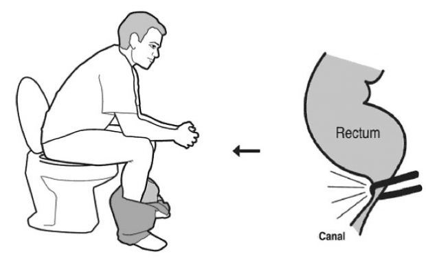 All of Us Sitting On The Toilet Incorrect - Here Is The Ideal Position