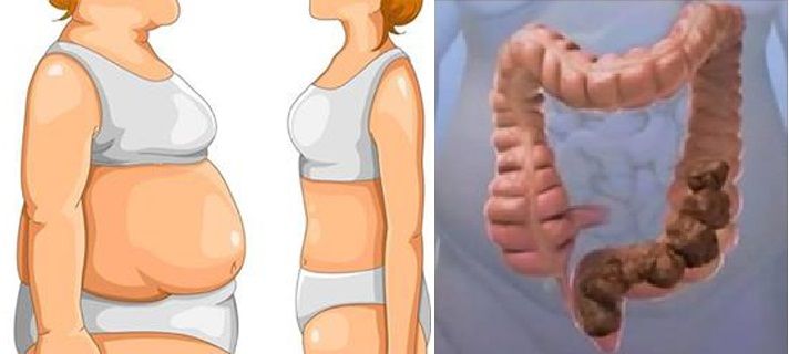 YOU'RE NOT FAT! YOU JUST GOT “POO POO” STUCK IN YOUR BODY! HERE IS HOW TO ELIMINATE IT INSTANTLY!