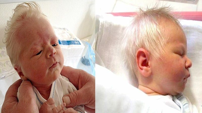 A Baby Born with a Full Head of Gray Hair Wins the Hearts of Everyone Around Him