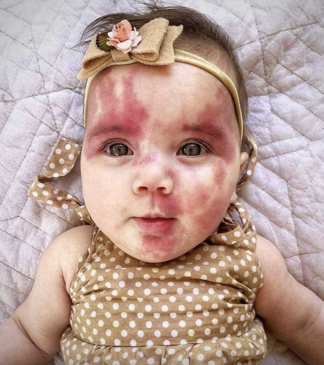 ‘Hideous’ baby has grown into a stunning young lady.