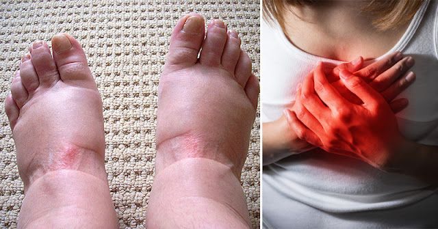 9 alarming warning signs of swollen feet you should never ignore