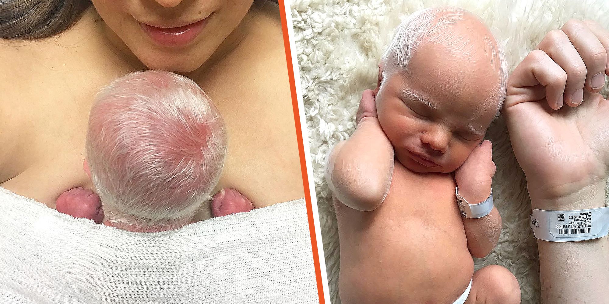 Baby mocked for having white hair – but wait until you see how he looks years later