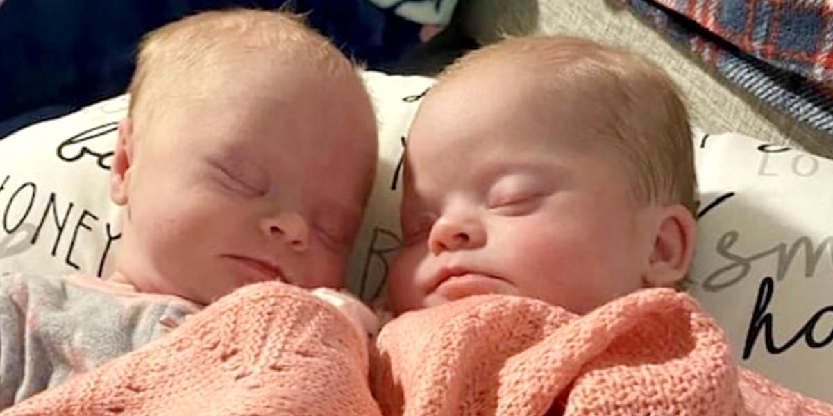 Florida woman gives birth to rare twins with Down syndrome