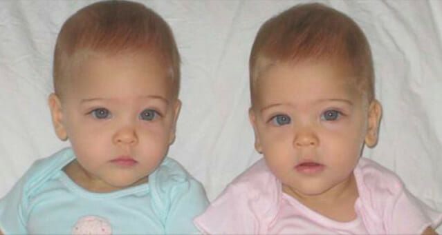 12 Years Ago They Were Called The World’s Most Beautiful Twins – Now Look At Them