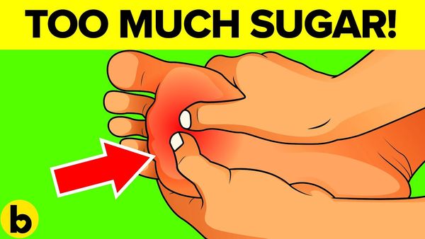 7 Indicators You Are Consuming Too A lot Sugar!
