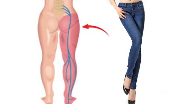 Never Ignore! Don’t Wear Too Tight Pants. Here’s Why
