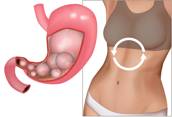 Quick and Natural Methods to Relieve Stomach Gas Discomfort